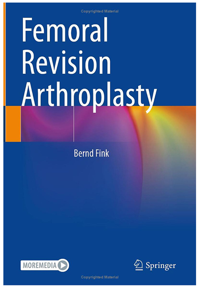 Femoral Revision Arthroplasty of Mr. Prof. Dr. med. Fink refers to theStemExtractor