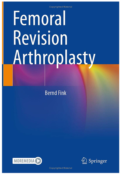 Femoral Revision Arthroplasty of Mr. Prof. Dr. med. Fink refers to the flexible chisels